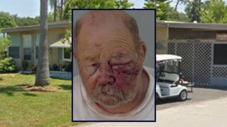 Florida Man Calls Woman Vulgar Name, Shoots Her in the Arm — Then Gets Beaten by Her Husband, Deputies Say