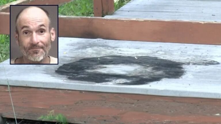 Missouri Man Charged With Murder After Setting Victim on Fire in Porch Attack That Burned 80% of His Skin